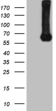 Monoclonal Mouse anti-Human PROZ / Protein Z Antibody (clone OTI1C10, aa115-400, WB)