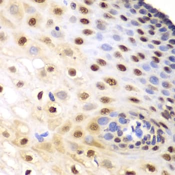 KPNA1 / Importin Alpha 5 Antibody