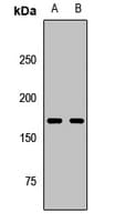 FANCI Antibody