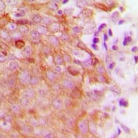 Polyclonal Rabbit anti-Human MRRF Antibody (C-Terminus, IHC, WB)