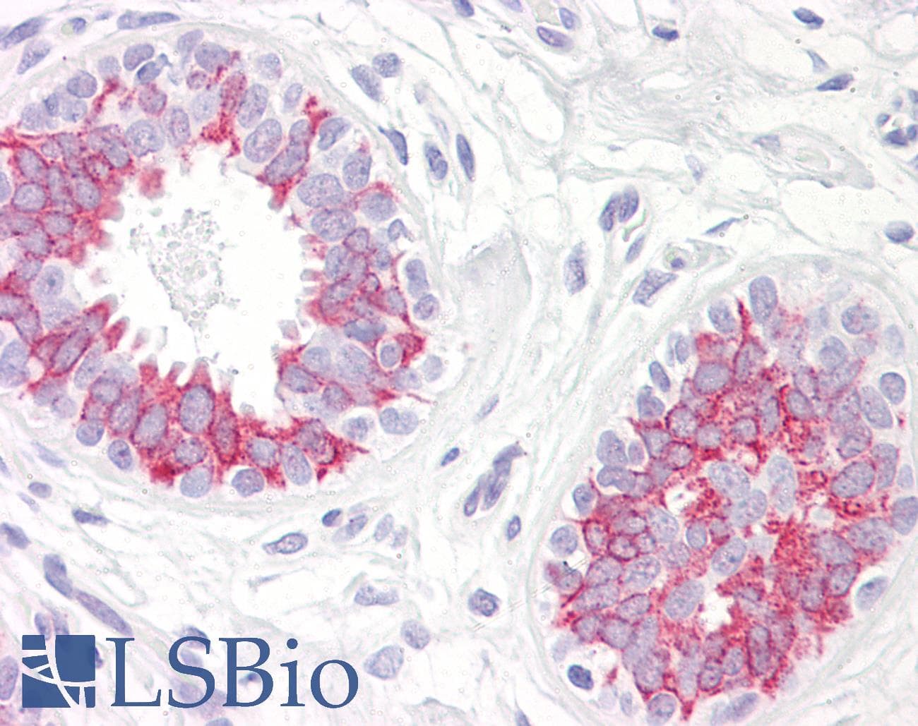 IHC-plus™ Polyclonal Rabbit anti-Human MAP2K1 / MKK1 / MEK1 Antibody (aa252-301, IHC, WB)
