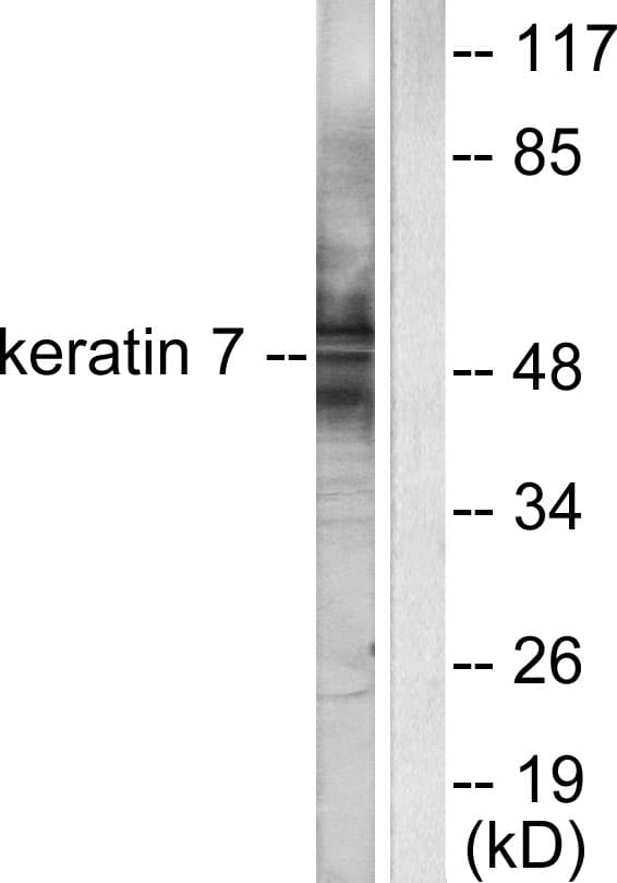 Polyclonal Rabbit anti-Human KRT7 / CK7 / Cytokeratin 7 Antibody (aa420-469, IHC, IF, WB)