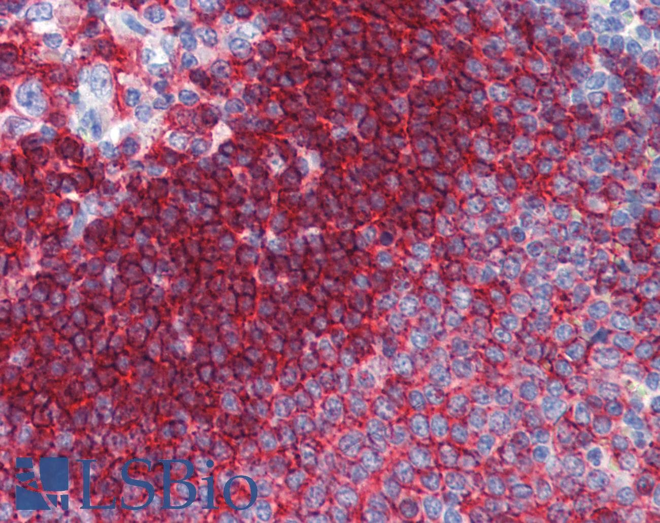 IHC-plus™ Monoclonal Mouse anti-Human CD37 Antibody (clone 2B8, IHC, IF)