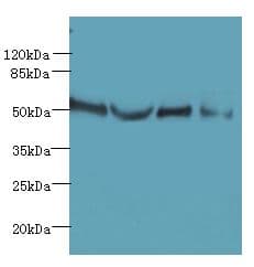Polyclonal Rabbit anti-Human TTC38 Antibody (IHC, WB)