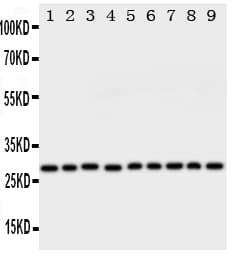 Polyclonal Rabbit anti-Human PRDX3 / Peroxiredoxin 3 Antibody (aa239-256, IHC, WB)
