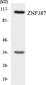IHC-plus™ Polyclonal Rabbit anti-Human ST18 Antibody (aa23-72, IHC, WB)