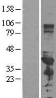 Human HnRNP-E1 / PCBP1 Protein (Over-Expression Lysate Myc-DDK (Flag))