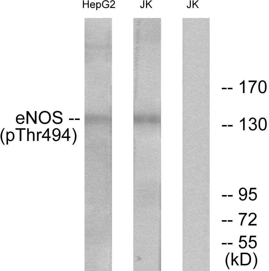 NOS3 / eNOS Antibody (phospho-Thr494)
