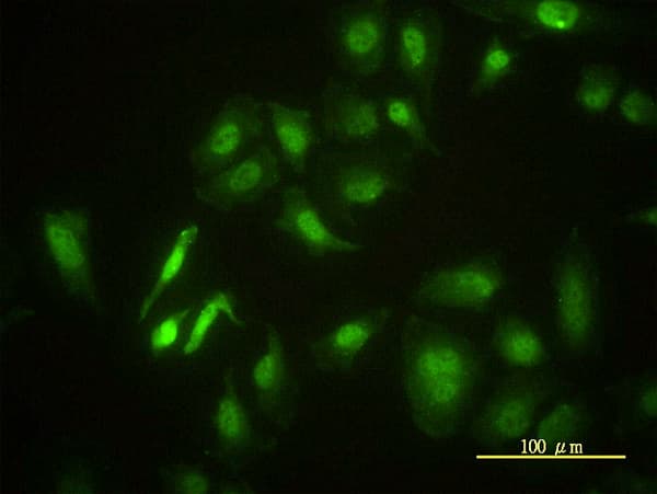 STK4 Antibody (clone 1D7-8A10)