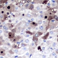 PSMD8 / RPN12 Antibody