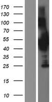 CCM2 / Malcavernin Protein (Over-Expression Lysate Myc-DDK (Flag))