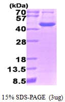 Human OAT Protein (Recombinant)