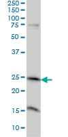 MRRF Antibody (clone 1D3)