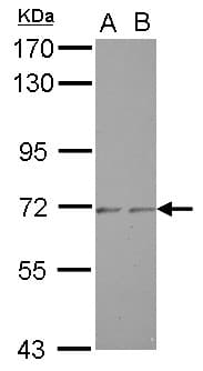 ZNF248 Antibody