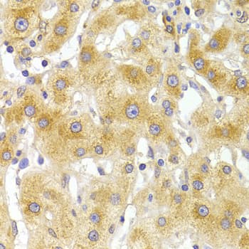 Polyclonal Rabbit anti-Human EIF4G1 / EIF4G Antibody (IHC, IF, WB)
