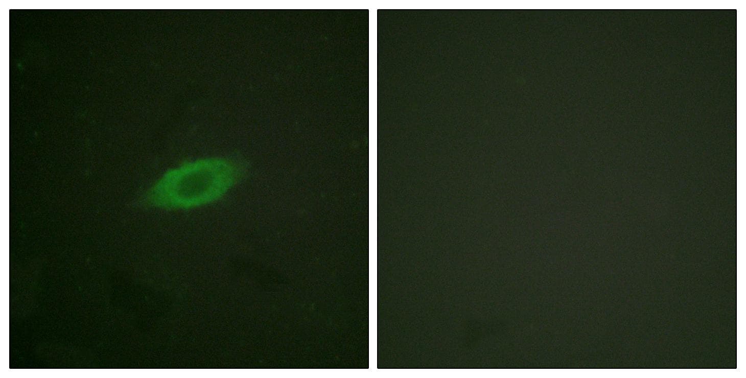 ANXA6/Annexin A6/Annexin VI Antibody