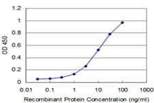 ROR2 Antibody (clone 4E1)