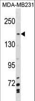 Polyclonal Rabbit anti-Human MYBBP1A Antibody (aa258-287, WB)