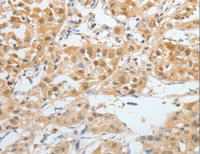 BPIFB2 Antibody
