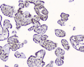 HMGN2 Antibody