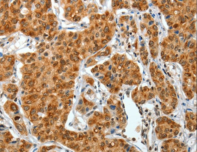 COL1A2 / Collagen I Alpha 2 Antibody
