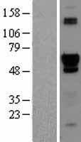 ACD / PTOP Protein (Over-Expression Lysate Myc-DDK (Flag))