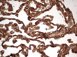 Monoclonal Mouse anti-Human GAPDH Antibody (clone OTI2F9, IHC, WB)