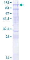 Human MYO9A Protein (Recombinant GST)