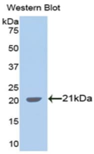 SPTAN1 / Alpha Fodrin Antibody (aa1573-1742)