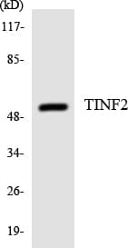 TINF2 Antibody (aa45-94)
