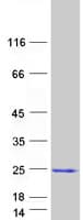 Human GCAP / GUCA1A Protein (Recombinant Myc-DDK (Flag))