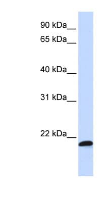 SPATC1L / C21orf56 Antibody (aa108-157)