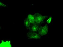 PIM2 / Pim-2 Antibody (clone OTI5D5)