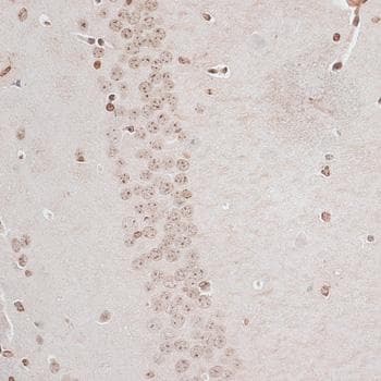ZNF177 / PIGX Antibody