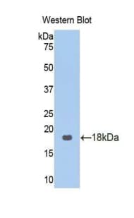 CAT / Catalase Antibody (aa32-157, HRP)