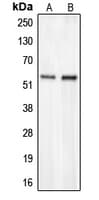 CHST2 Antibody (N-Terminus)