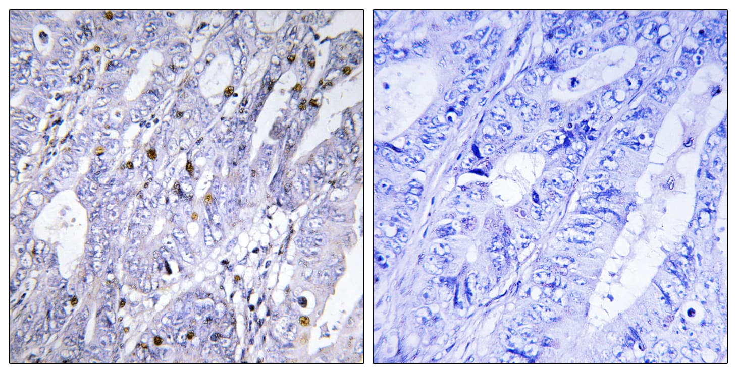 MEF2D Antibody (aa410-459)