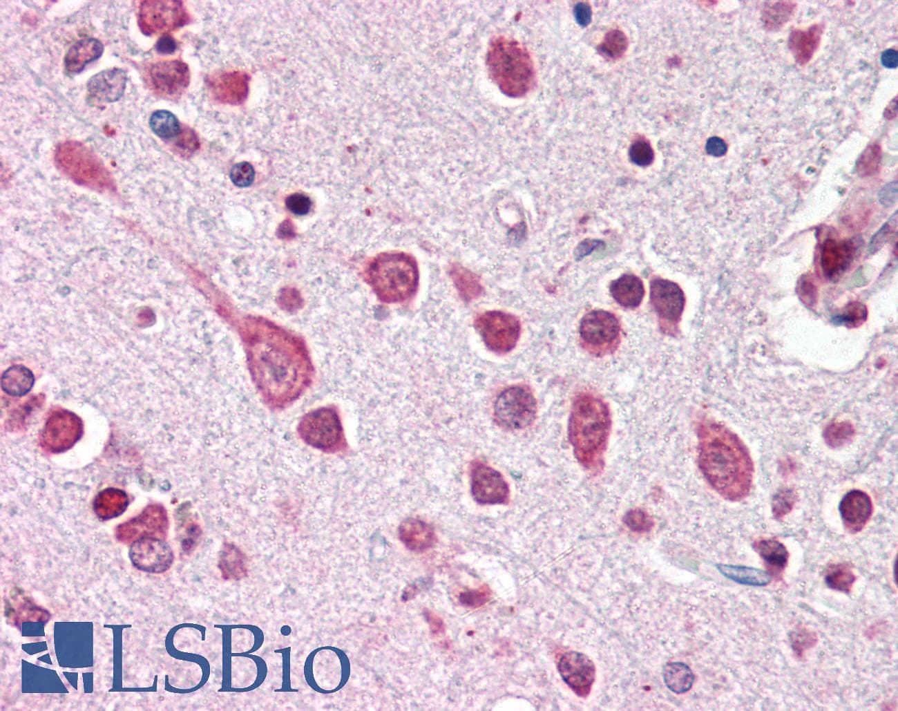 IHC-plus™ CUL7 Antibody (aa1675-1698)