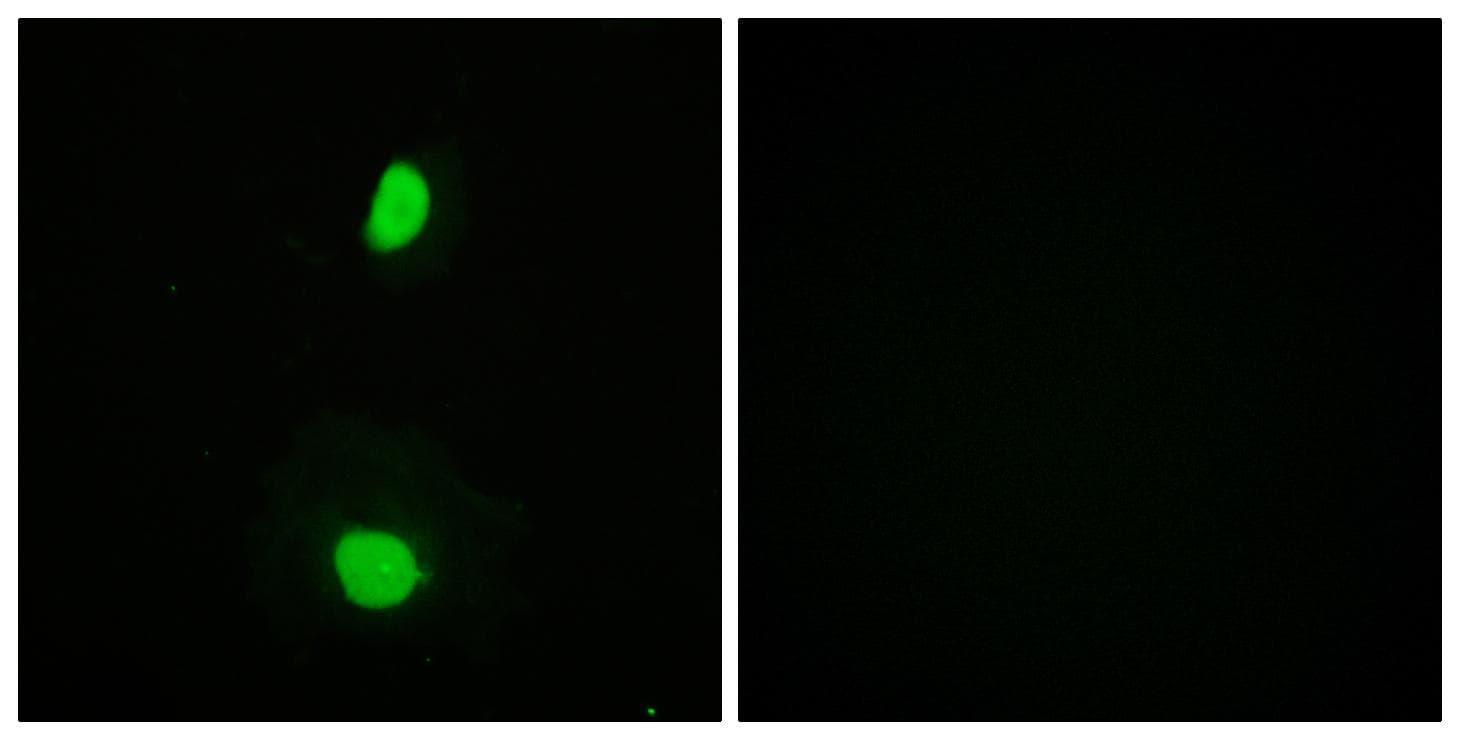 KAT5 / TIP60 Antibody (Ab-86)