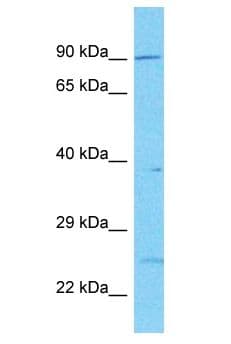 PDE10A Antibody (aa24-73)