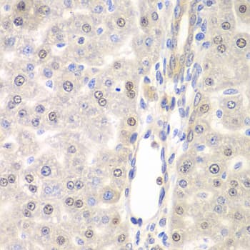 Polyclonal Rabbit anti-Human DTX2 Antibody (IHC, WB)