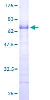 Human DLX3 Protein (Recombinant GST)