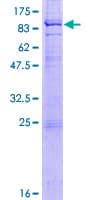 Human RAG2 / RAG-2 Protein (Recombinant GST)