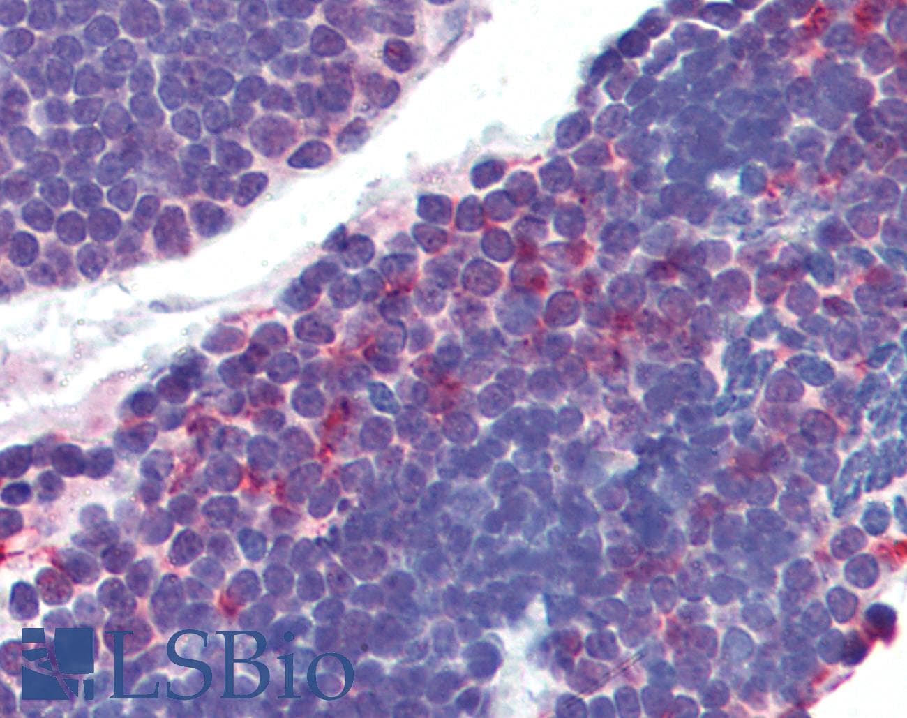 IHC-plus™ Polyclonal Rabbit anti-Human AKT1 + AKT2 Antibody (IHC, WB)