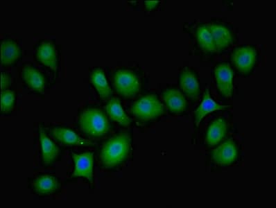 Polyclonal Rabbit anti-Human PIP4K2B Antibody (aa1-270, IHC, WB)