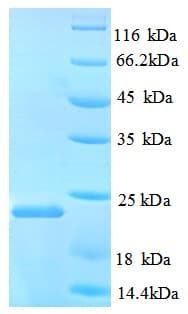 Rat NANOS3 / NOS-3 Protein (Recombinant His)