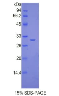 Mouse IL17RC Protein (Recombinant His)