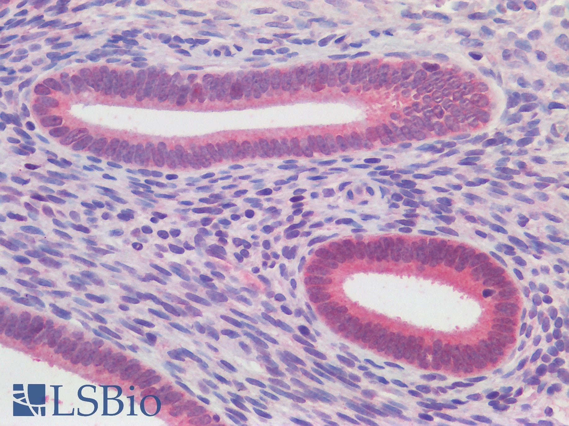 IHC-plus™ Polyclonal Rabbit anti-Human ATG16L1 / ATG16L Antibody (IHC, IF, WB)