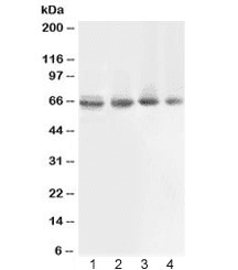 Polyclonal Rabbit anti-Human ABCB10 Antibody (WB)