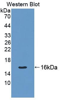 KRT7 / CK7 / Cytokeratin 7 Antibody (aa394-457)